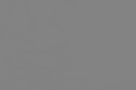 neonato con crosta lattea che dorme